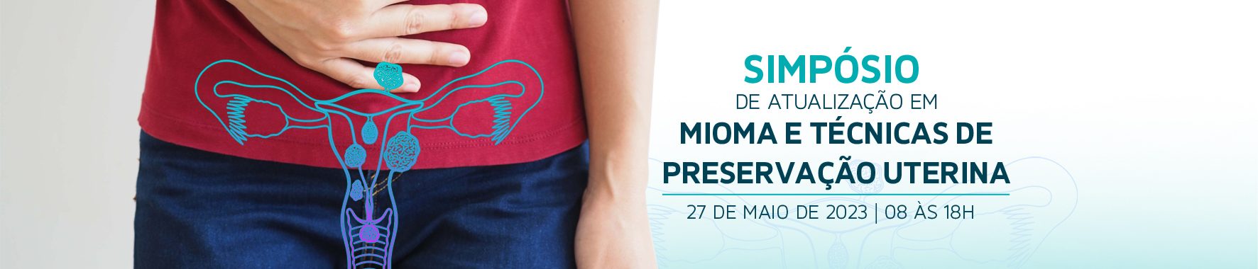 SIMPÓSIO DE MIOMA UTERINO SIMPÓSIO DE MIOMA UTERINO