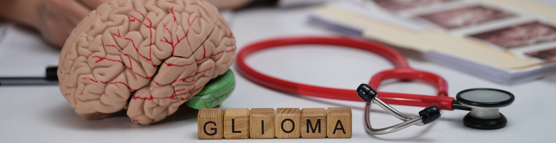 Modelo anatômico de cérebro sobre a mesa, ao lado de um estetoscópio vermelho e cubos de madeira que formam a palavra “GLIOMA”, com exames médicos ao fundo.