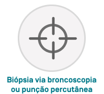 Biópsia via broncoscopia ou punição percutânea