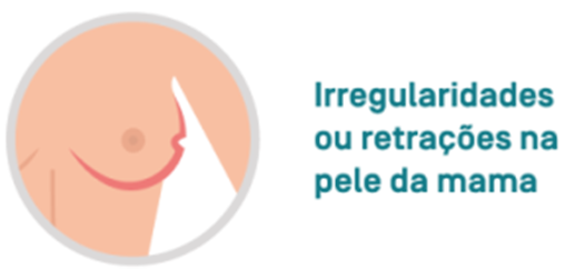 Irregularidades ou retrações na pele da mama