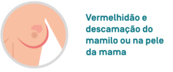 Vermelhidão e descamação do mamilo ou na pele da mama