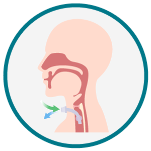 Diagrama do fluxo respiratório por traqueostomia. Ilustração lateral do trato respiratório com cânula de traqueostomia na traqueia e setas coloridas mostrando o fluxo de ar.