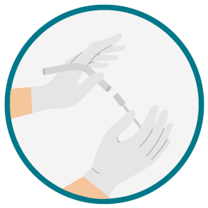 Manuseio do cateter de sucção para higiene da traqueostomia. Ilustração de duas mãos enluvadas preparando um cateter de sucção fino para limpeza das vias aéreas de uma traqueostomia.