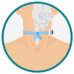 Verificação da folga da fita de fixação da traqueostomia com dedo enluvado. Ilustração frontal do pescoço com estoma de traqueostomia; dedo enluvado desliza sob a fita azul para conferir a folga correta do dispositivo.