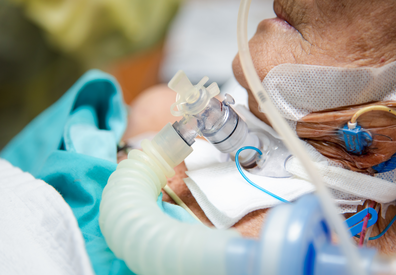 Paciente com cânula de traqueostomia conectada a ventilador mecânico em ambiente hospitalar