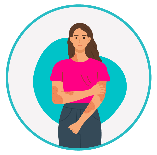 Mulher com coceira e lesões na pele, sinal de alergia ou dermatite. Ilustração de uma mulher com lesões avermelhadas na pele e coceira intensa nos braços e pescoço, indicando possível reação alérgica ou condição dermatológica.