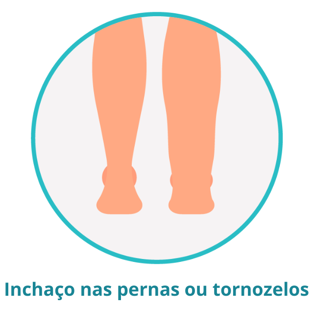 Inchaço nas pernas ou tornozelos Inchaço nas pernas ou tornozelos